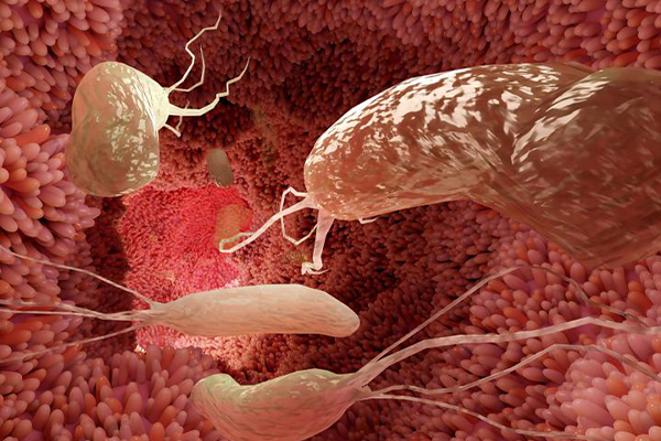 Holistic-Approach-to-H-Pylori-infection-A-Case-Study