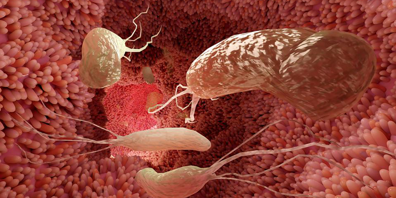 Holistic-Approach-to-H-Pylori-infection-A-Case-Study